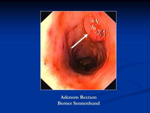 Chirurgie an Perineum, Rectum und Anus