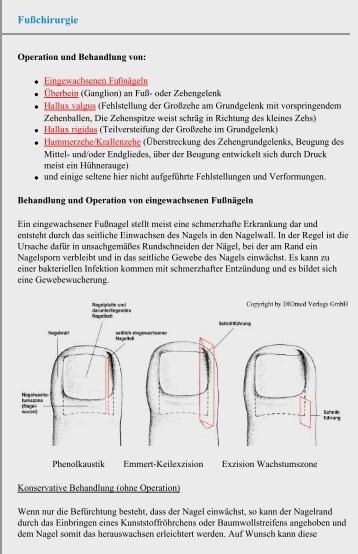 Fußchirurgie - Chirurgie Heidelberg