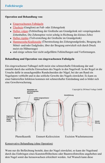 Fußchirurgie - Chirurgie Heidelberg