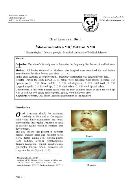 Oral Lesions at Birth