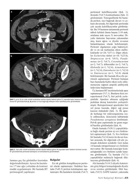 BT ile deÄerlendirme - Diagnostic and Interventional Radiology