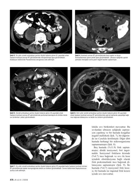 BT ile deÄerlendirme - Diagnostic and Interventional Radiology