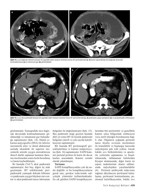 BT ile deÄerlendirme - Diagnostic and Interventional Radiology