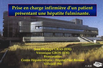 CHB Hépatite fulminante - Infirmiers.com