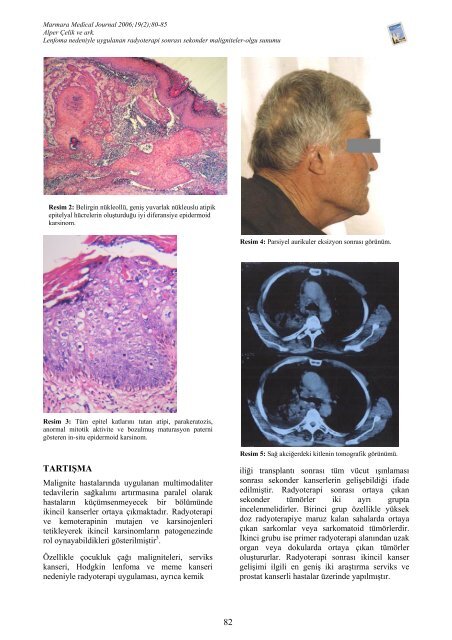 Tam Metin PDF (3983 KB) - Marmara Medical Journal