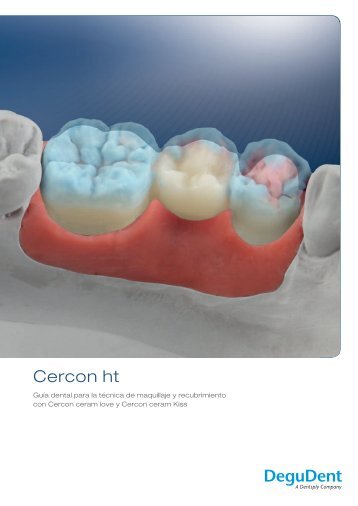 Cercon ht - DeguDent