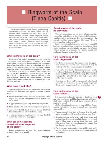 Ringworm of the Scalp (Tinea Capitis) - Nelson Instructions Pediatric ...
