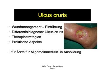 Ulcus cruris