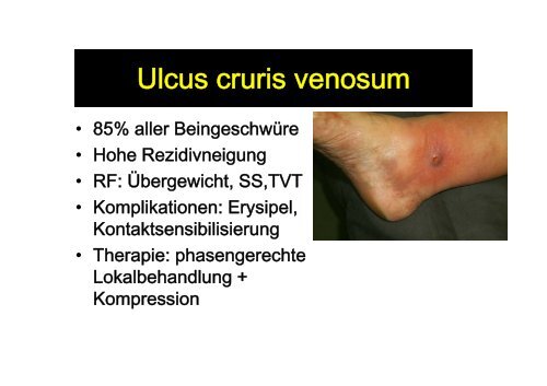 Ulcus