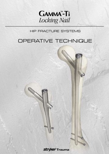 Gamma-Ti Locking Nail Operative Technique - Stryker