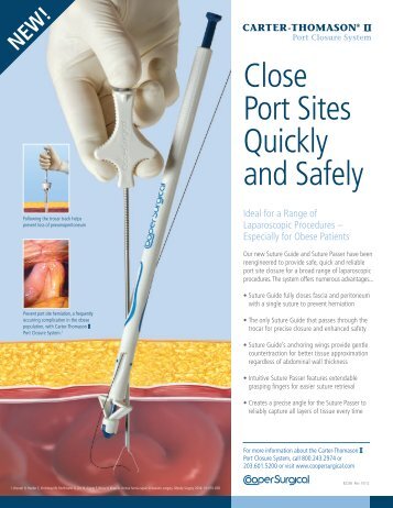 Close Port Sites Quickly and Safely - CooperSurgical