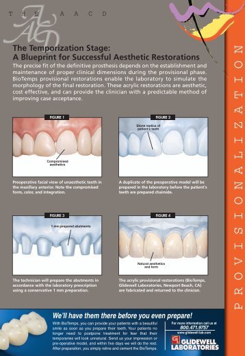 BioTemps Provisionalization - Glidewell Dental Labs