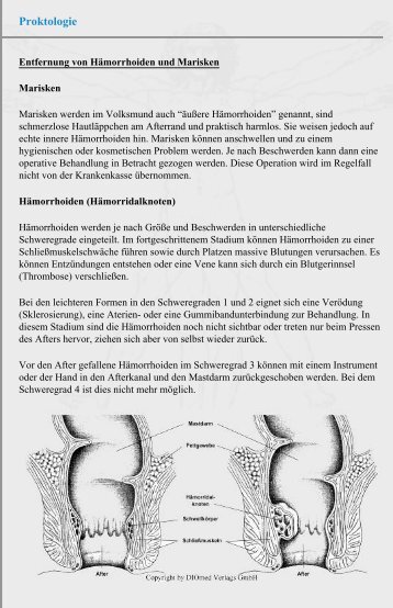 Proktologie - Chirurgie Heidelberg