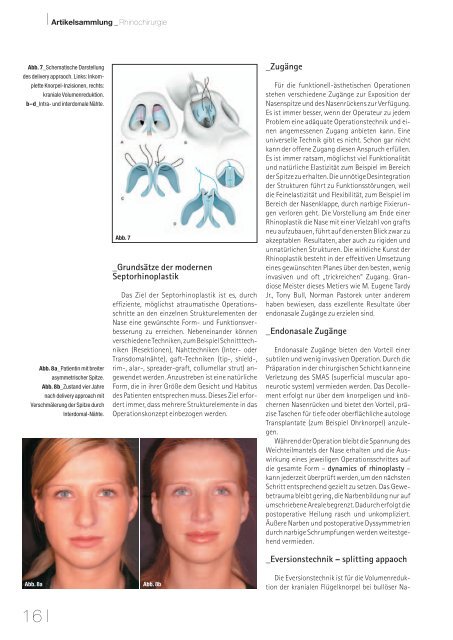 Ãsthetische Medizin - Nasenkorrekturen - Park Klinik WeiÃensee