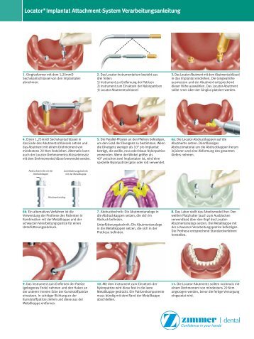 Locator Rest Guide Germany_5519.qxp - Zimmer Dental