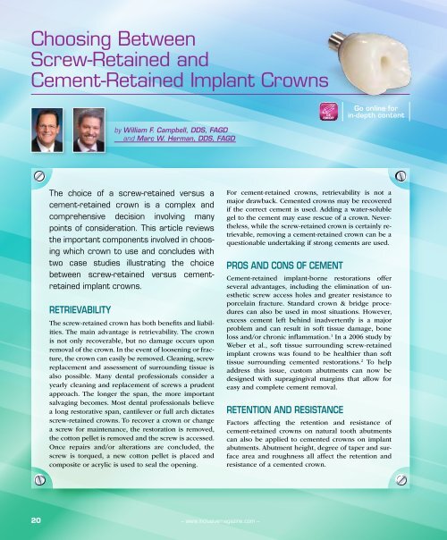 Choosing Between ScrewRetained and CementRetained Implant