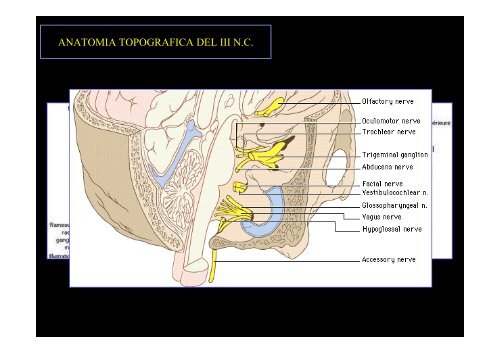 Diplopia nelle paresi e nelle paralisi del nervo oculomotore