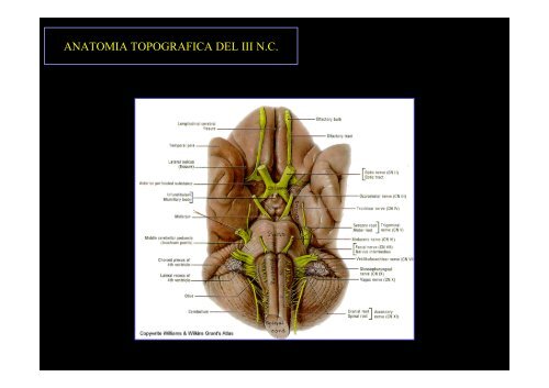 Diplopia nelle paresi e nelle paralisi del nervo oculomotore