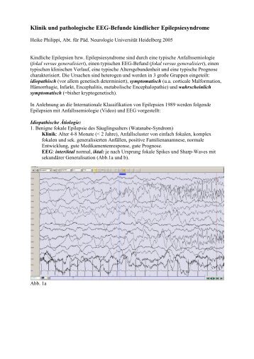 Klinik und EEG kindlicher Epilepsiesyndrome - Schule & Gesundheit