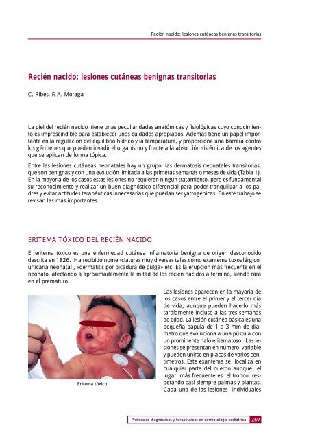 Lesiones cutÃ¡neas del reciÃ©n nacido - EnfermerÃa Cuidados CrÃticos 