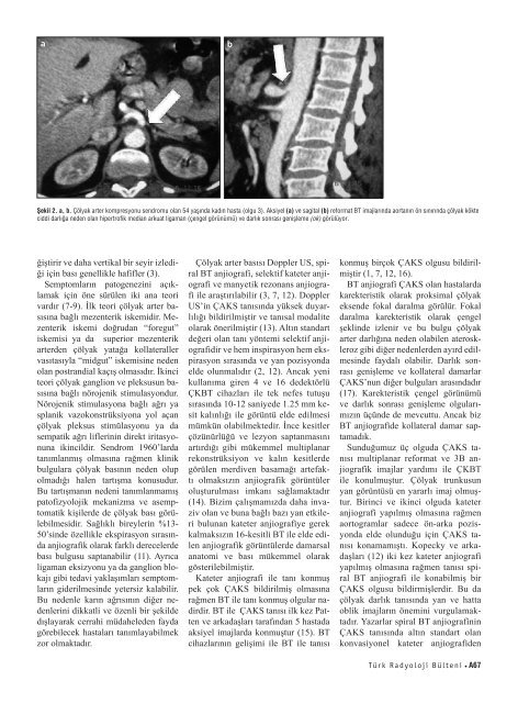 Ã§ok kesitli BT bulgularÄ± - Diagnostic and Interventional Radiology