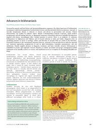 Seminar Advances in leishmaniasis