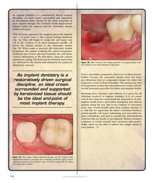 PDF Download - Glidewell Dental Labs