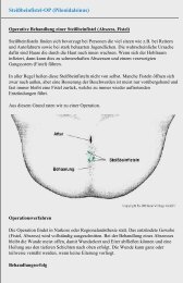 Steißbeinfistel-OP (Pilonidalsinus) - Chirurgie Heidelberg