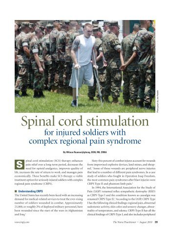 Spinal Cord Stimulation - Reflex Sympathetic Dystrophy Association ...