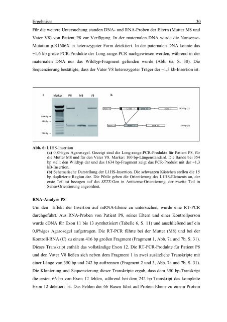 Ataxie mit okulomotorischer Apraxie Typ 2: Charakterisierung des ...