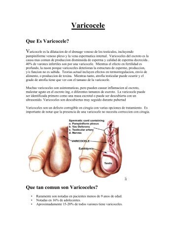 Varicocele - OU Medicine