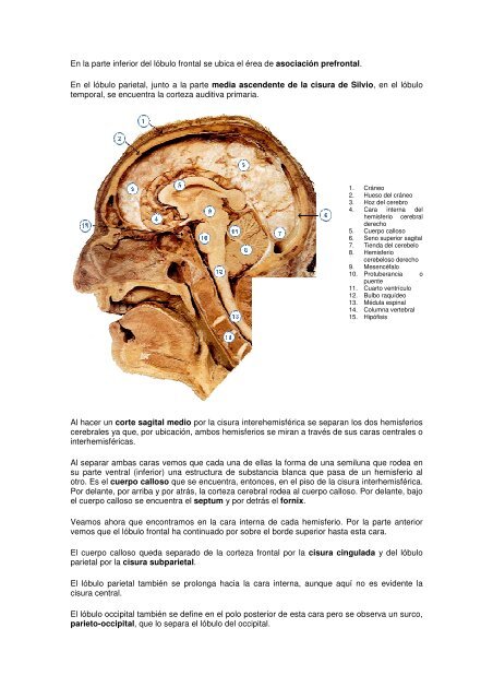 EL SISTEMA NERVIOSO - Emagister