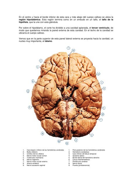 EL SISTEMA NERVIOSO - Emagister