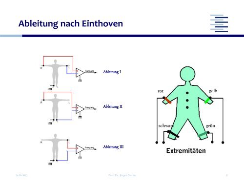 EKG Befundung