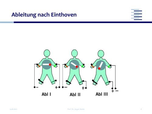 EKG Befundung