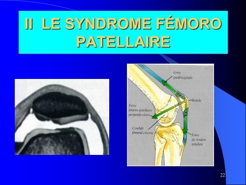 MESOTHERAPIE et GENOU