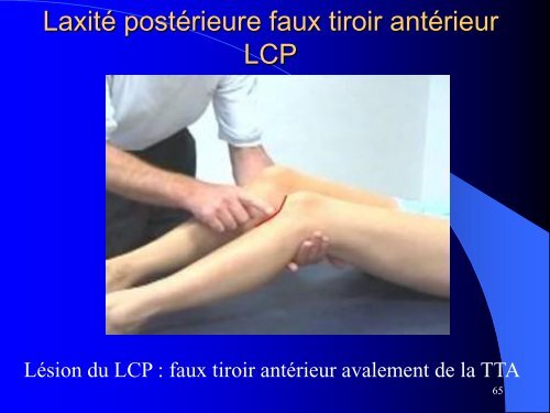 MESOTHERAPIE et GENOU