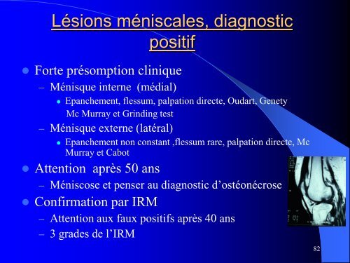 MESOTHERAPIE et GENOU