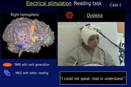 MEG/EEG in clinical practice