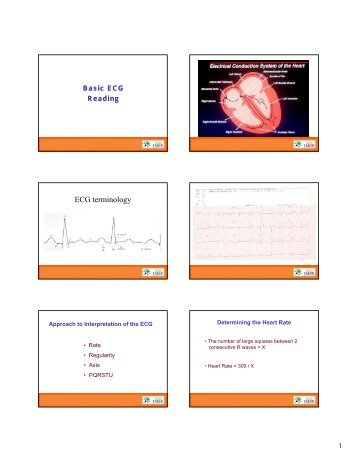 Basic ECG Reading