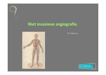 Dr. Hendrik Mertens - Niet invasieve angiografie