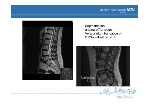 Imaging of the Spine - Croydon Health Services NHS Trust