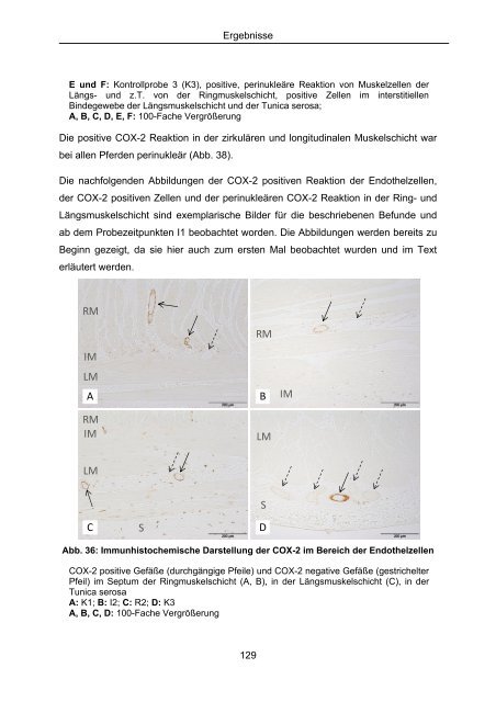 Effekt selektiver und nicht selektiver nichtsteroidaler Antiphlogistika ...