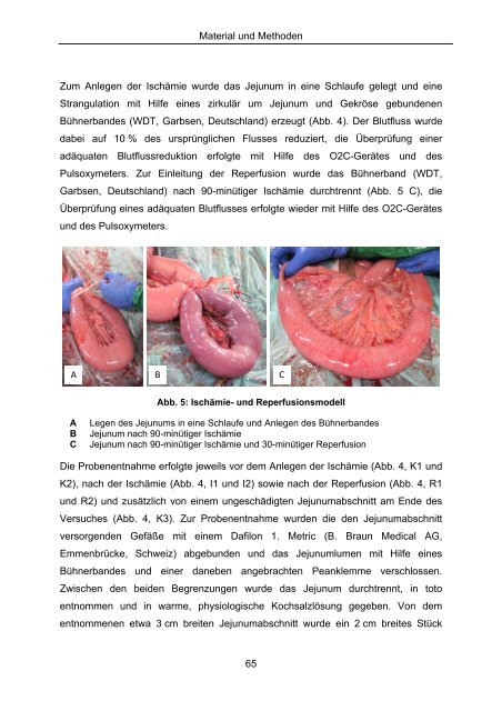 Effekt selektiver und nicht selektiver nichtsteroidaler Antiphlogistika ...