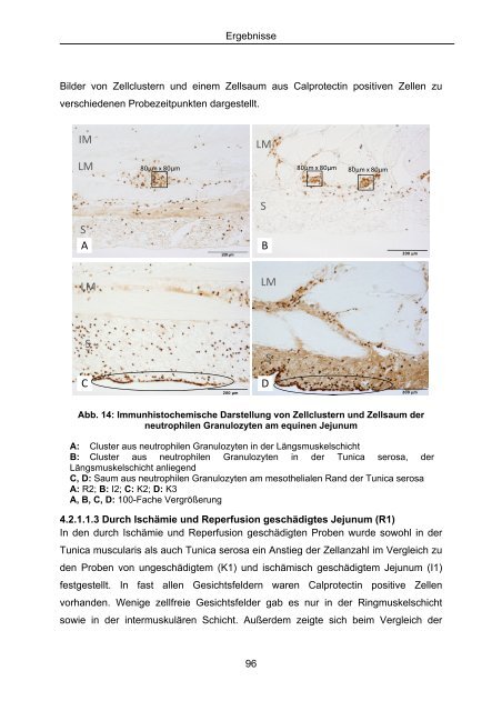 Effekt selektiver und nicht selektiver nichtsteroidaler Antiphlogistika ...