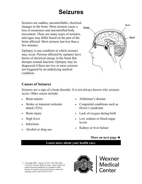 Seizures - Patient Education Home