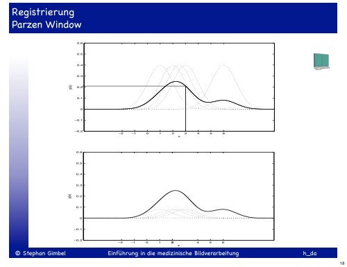 Einführung in die medizinische Bildverarbeitung SS 2013