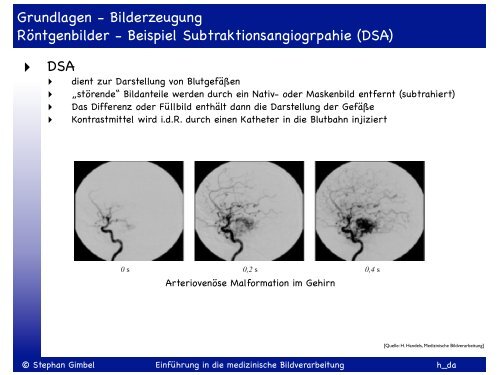 Einführung in die medizinische Bildverarbeitung SS 2013