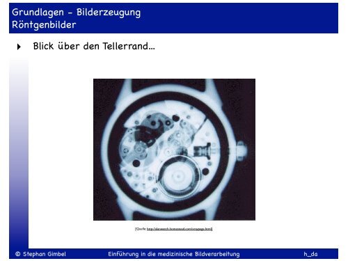 Einführung in die medizinische Bildverarbeitung SS 2013