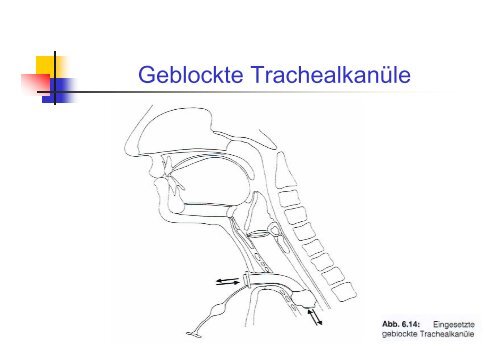 Diagnose und Therapie neurologisch bedingter SchluckstÃ¶rungen